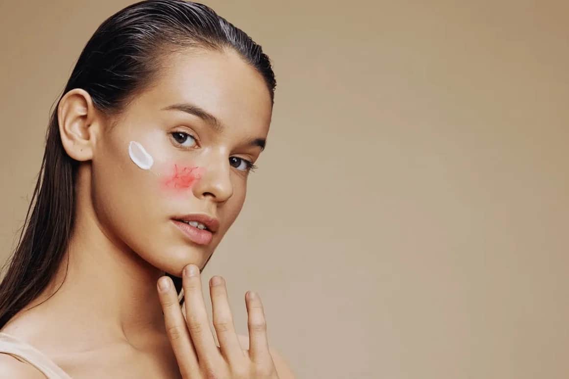 Cera naczynkowa: Czego unikać? Pielęgnacja, dieta, styl życia