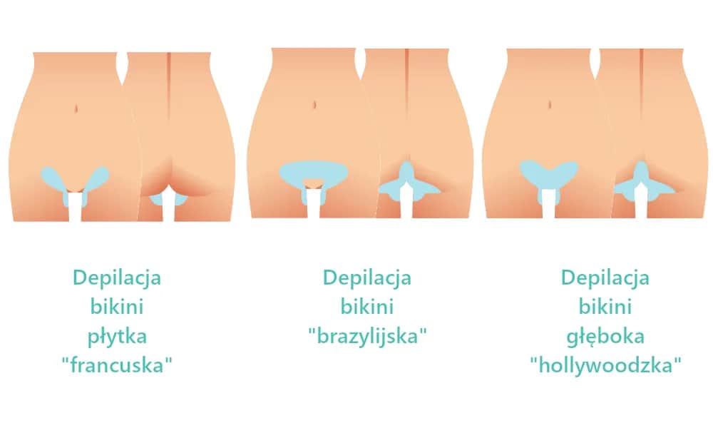 Depilacja bikini głębokiego: Co obejmuje? Różnice i efekty