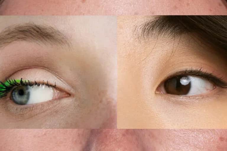 Rozjaśnij cerę: Skuteczne metody na przebarwienia i równy koloryt